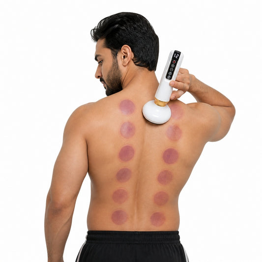 Man using electric cupping massager on his back with dry cupping marks