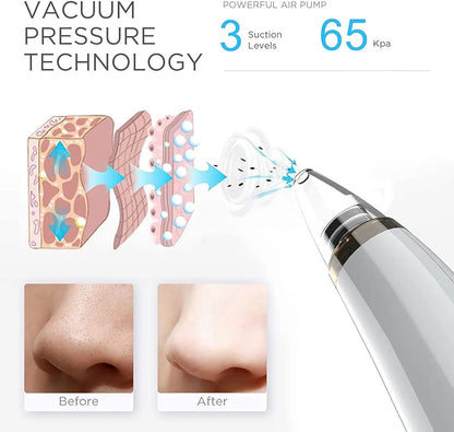 5 in 1 Electric Blackhead Acne Oil Remover